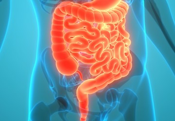 É preciso mais sensibilização e apoio para as pessoas com Síndrome do Intestino Curto