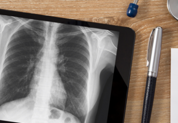 Futuro do diagnóstico das doenças intersticiais pulmonares com novidades